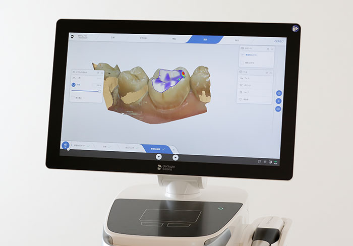 CEREC Primescan